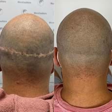 smp